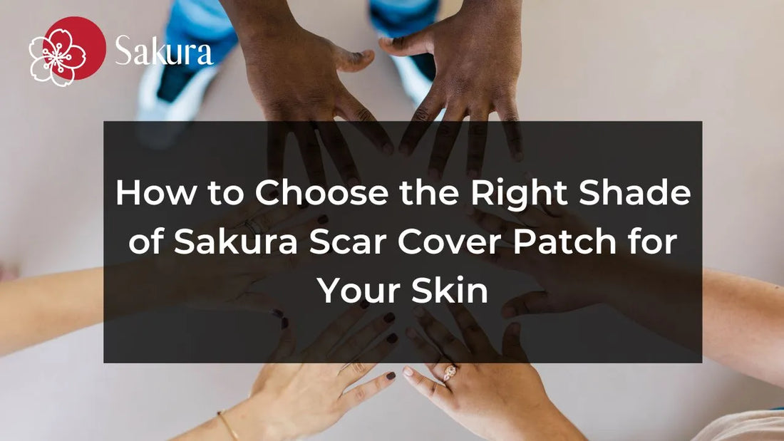 How to Choose the Right Shade of Sakura Scar Cover Patch for Your Skin
